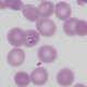 A laboratory slide showing a red blood cell containing a malaria parasite (purple ring with a dark purple dot).
